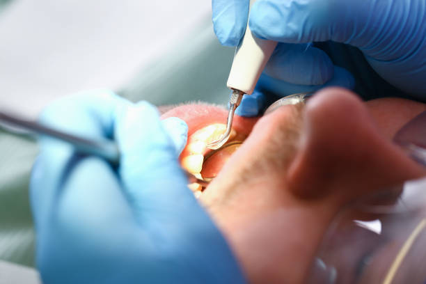 Best Broken Tooth Emergency  in Westerville, OH