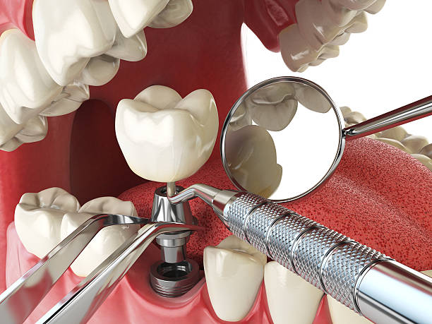 Best Emergency Tooth Extraction  in Westerville, OH