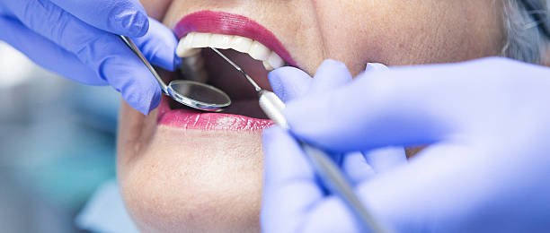 Best Knocked-Out Tooth Emergency  in Westerville, OH